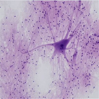 #14 - Apprendre à désapprendre pour reprogrammer l'inconscient cover