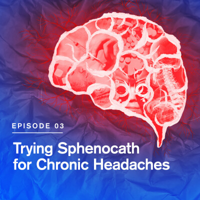 Trying Sphenocath for Chronic Headaches cover