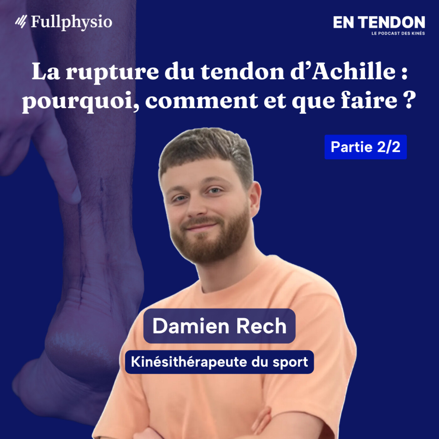 #30.2 - La rupture du tendon d'Achille : pourquoi, comment et que faire en rééducation ? | Damien Rech (@le_d_physiosport), kiné du sport #30.2 - La rupture du tendon d'Achille : pourquoi, comment et que faire en rééducation ? | Damien Rech (@le_d_physiosport), kiné du sport