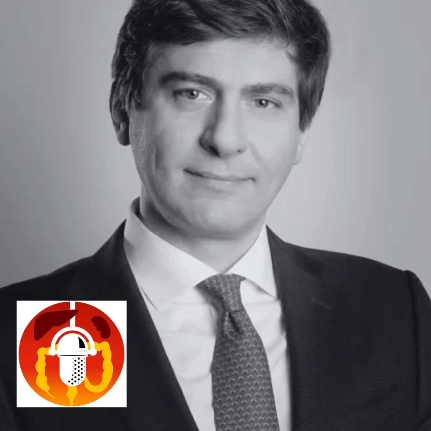 Tout savoir sur le ByPass en oméga - Pr Tigran Poghosyan