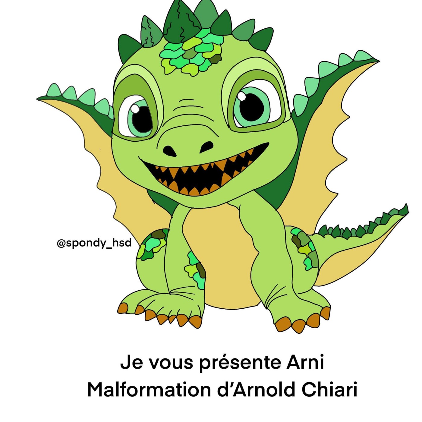 Malformation d'Arnold Chiari