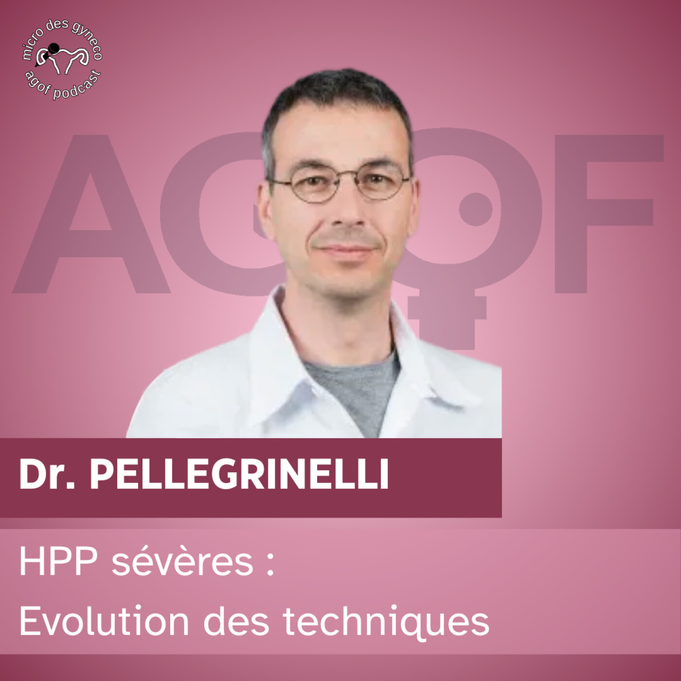 HPP sévères : évolutions techniques HPP sévères : évolutions techniques