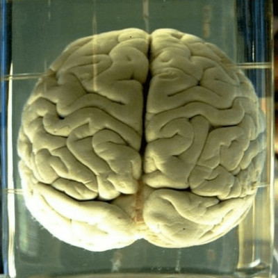 C'est quoi le cerveau ? (S1EP01) cover
