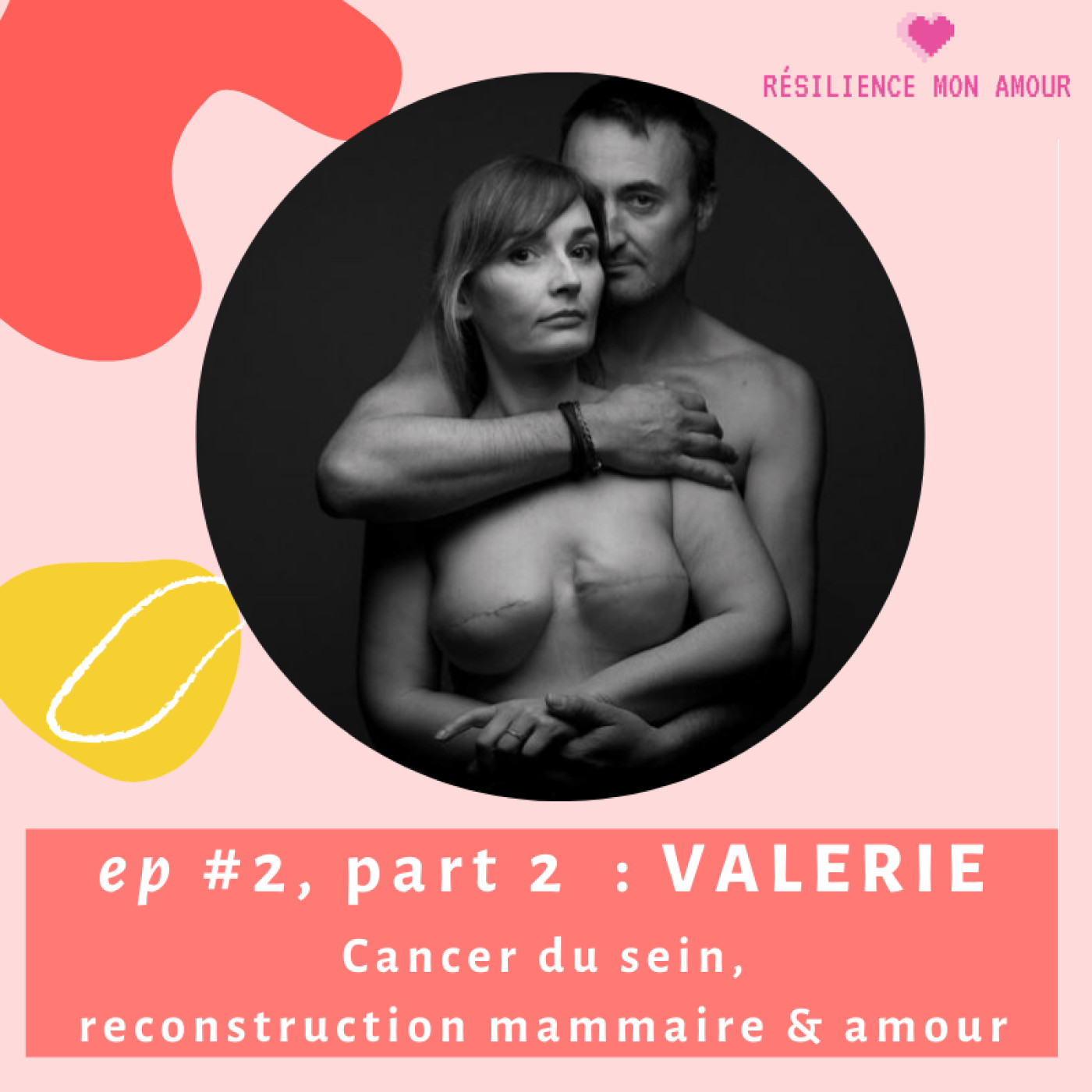 Ep #2 part 2 : VALERIE - cancer du sein, reconstruction mammaire & amour