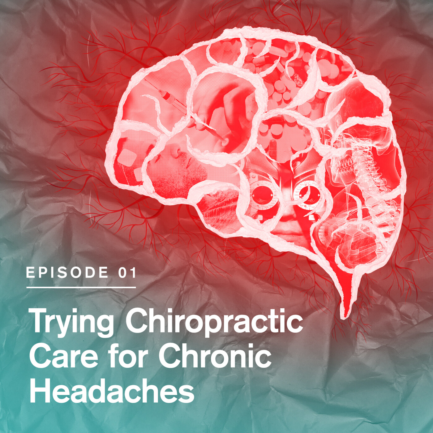 This Headache Journey