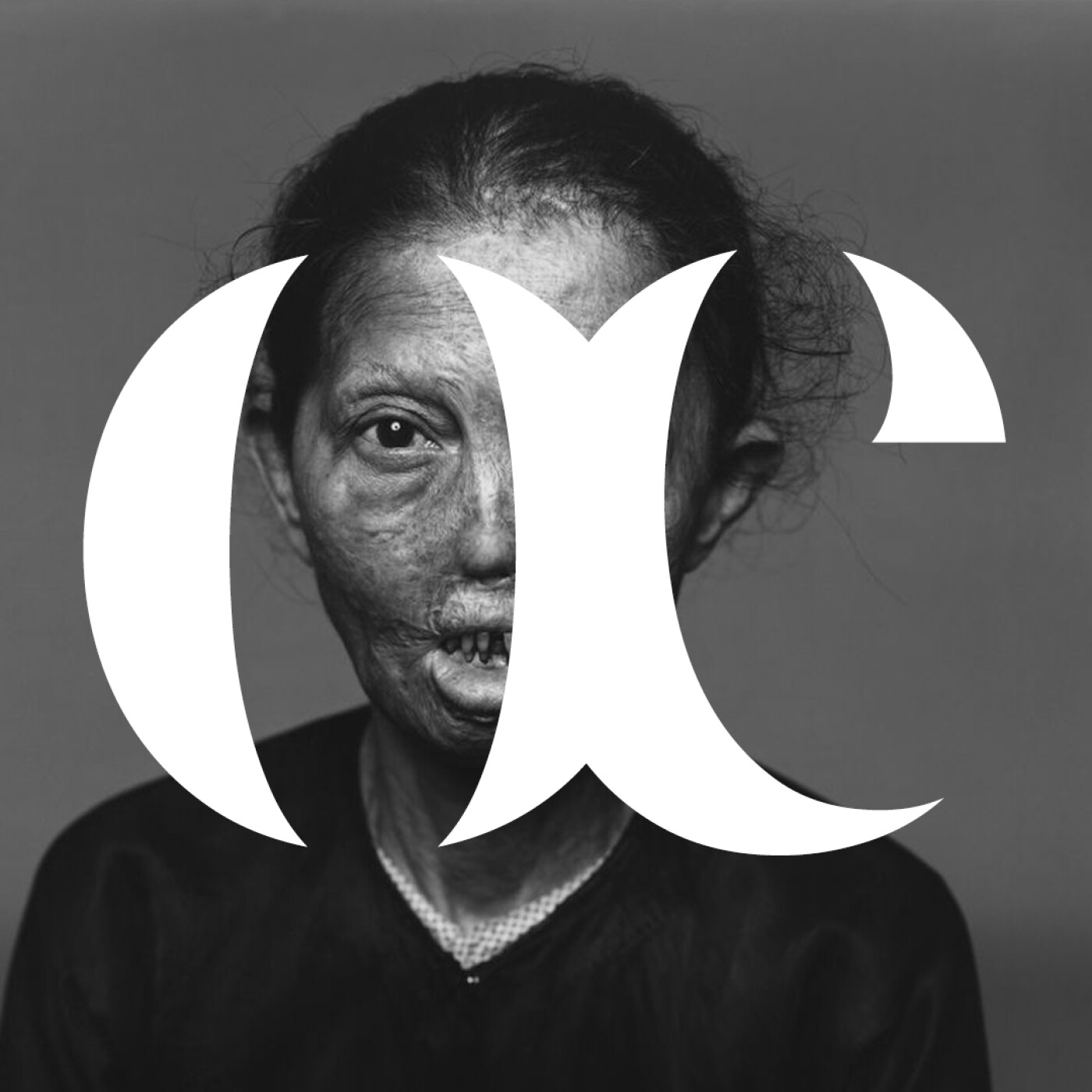 Episode 4 - Napalm victim - Richard Avedon