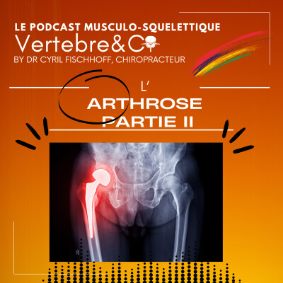 Tout sur l'Arthrose ! (Partie 2) cover