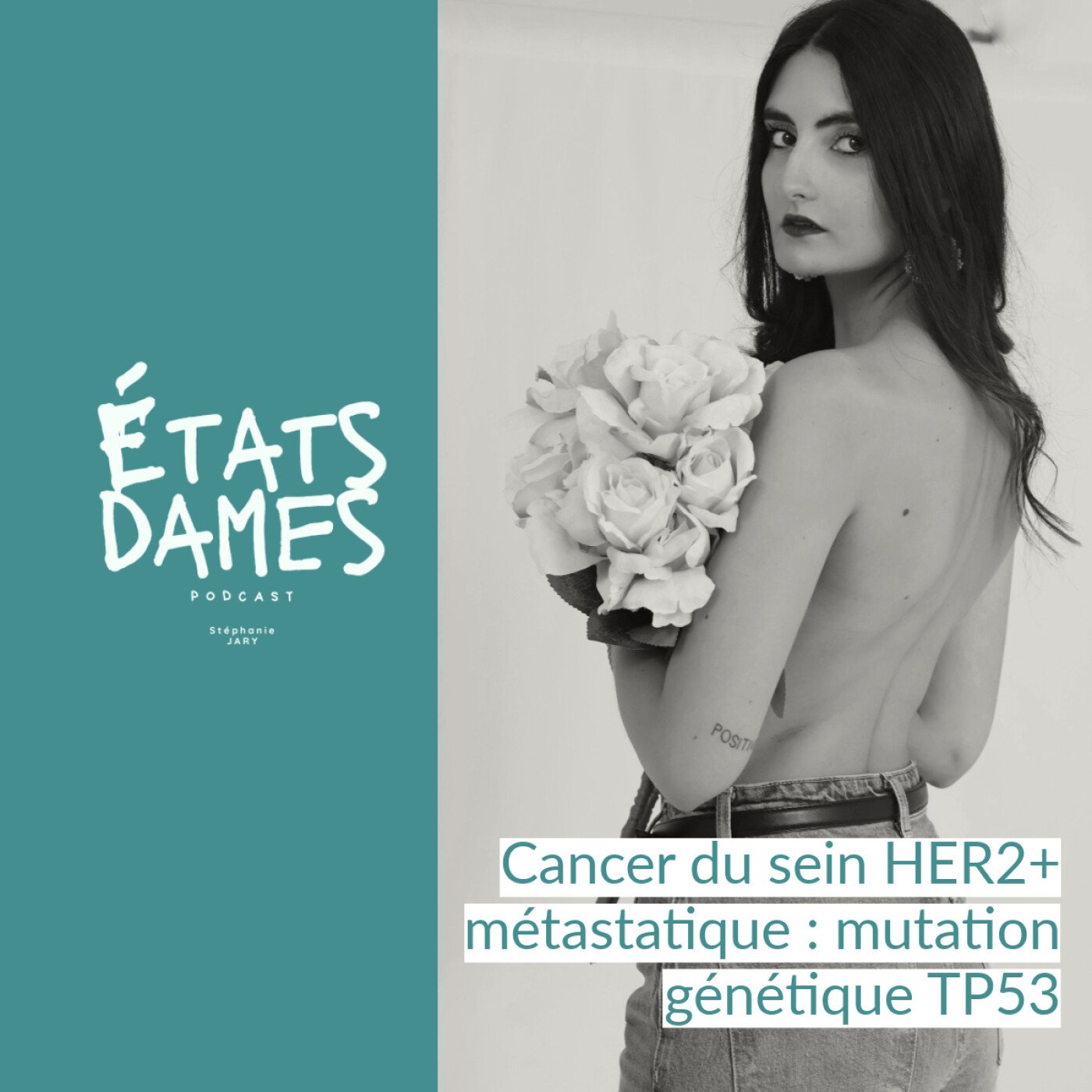 Au cœur d’un cancer du sein HER2+ métastatique : mutation génétique TP53