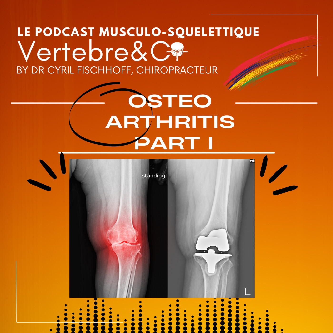 OsteoArthritis Part I episode artwork