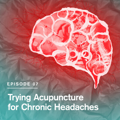 Trying Acupuncture for Chronic Headaches cover