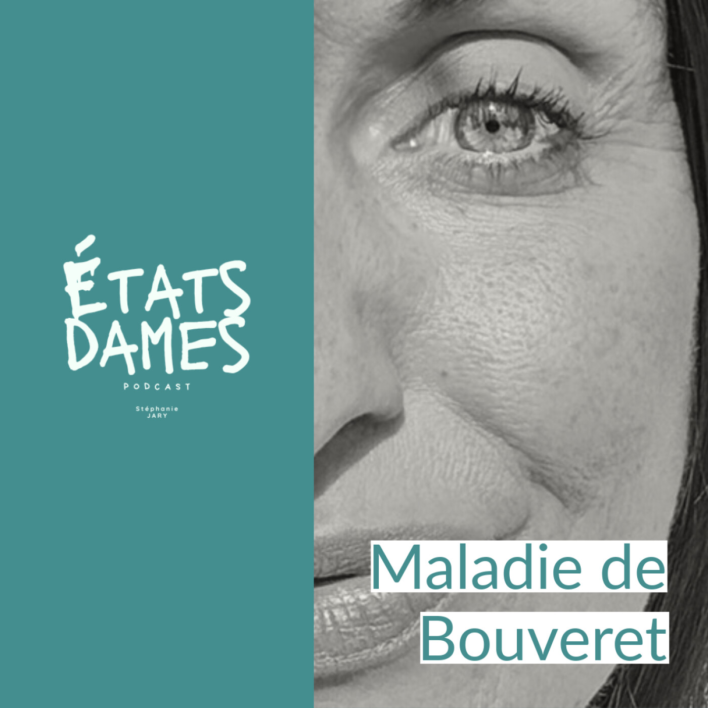 Au cœur du syndrome de Bouveret : 25 ans d’errance, de solitude et de renaissance Au cœur du syndrome de Bouveret : 25 ans d’errance, de solitude et de renaissance