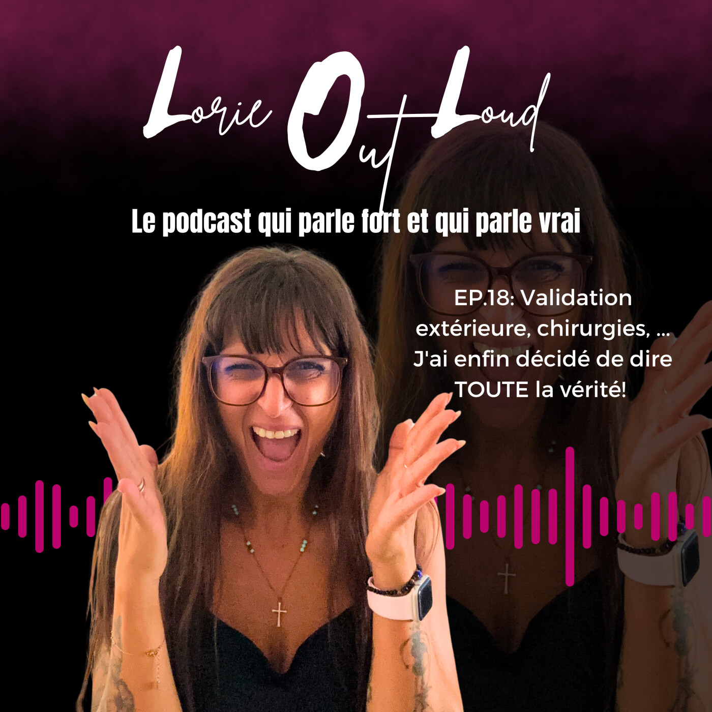 EP.18: Validation extérieure, chirurgies, ... J'ai enfin décidé de dire TOUTE la vérité! episode artwork