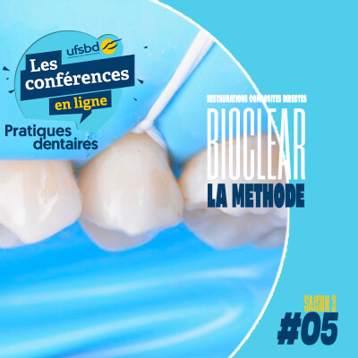 Restaurations composites directes : la méthode Bioclear cover