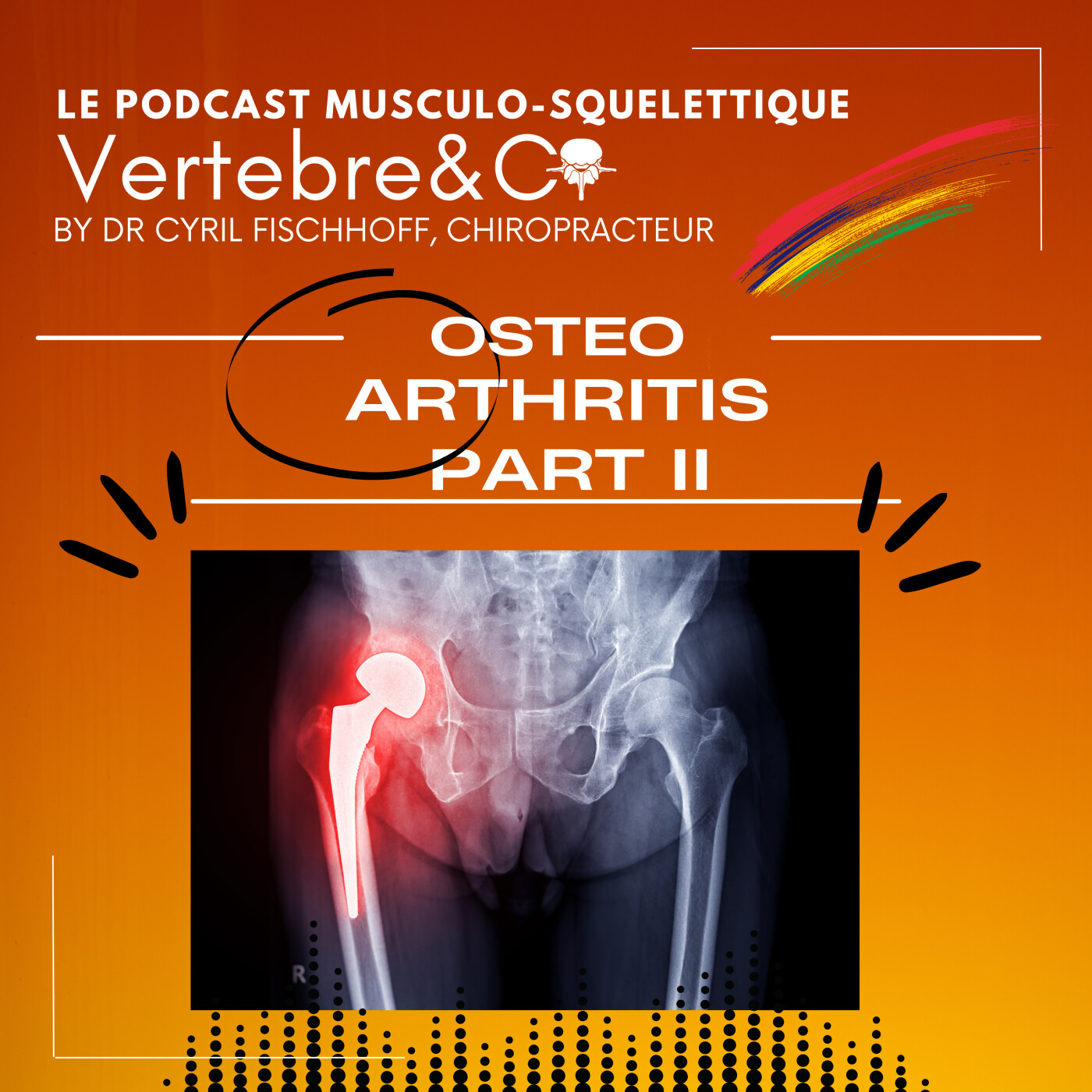 Osteo-Arthritis Part II episode artwork
