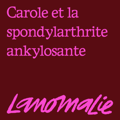 "J'ai toujours voulu danser : cet état me permet de ne plus penser à la douleur." - Carole, la spondylarthrite ankylosante et les douleurs cover