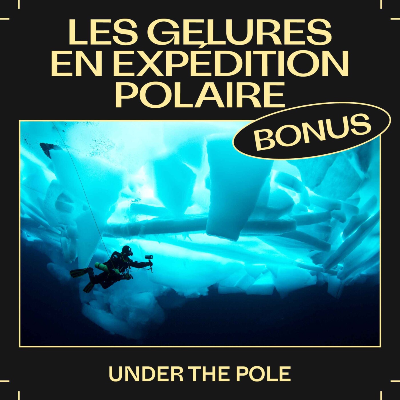 Bonus E40 — Les gelures en expédition polaire avec Under The Pole