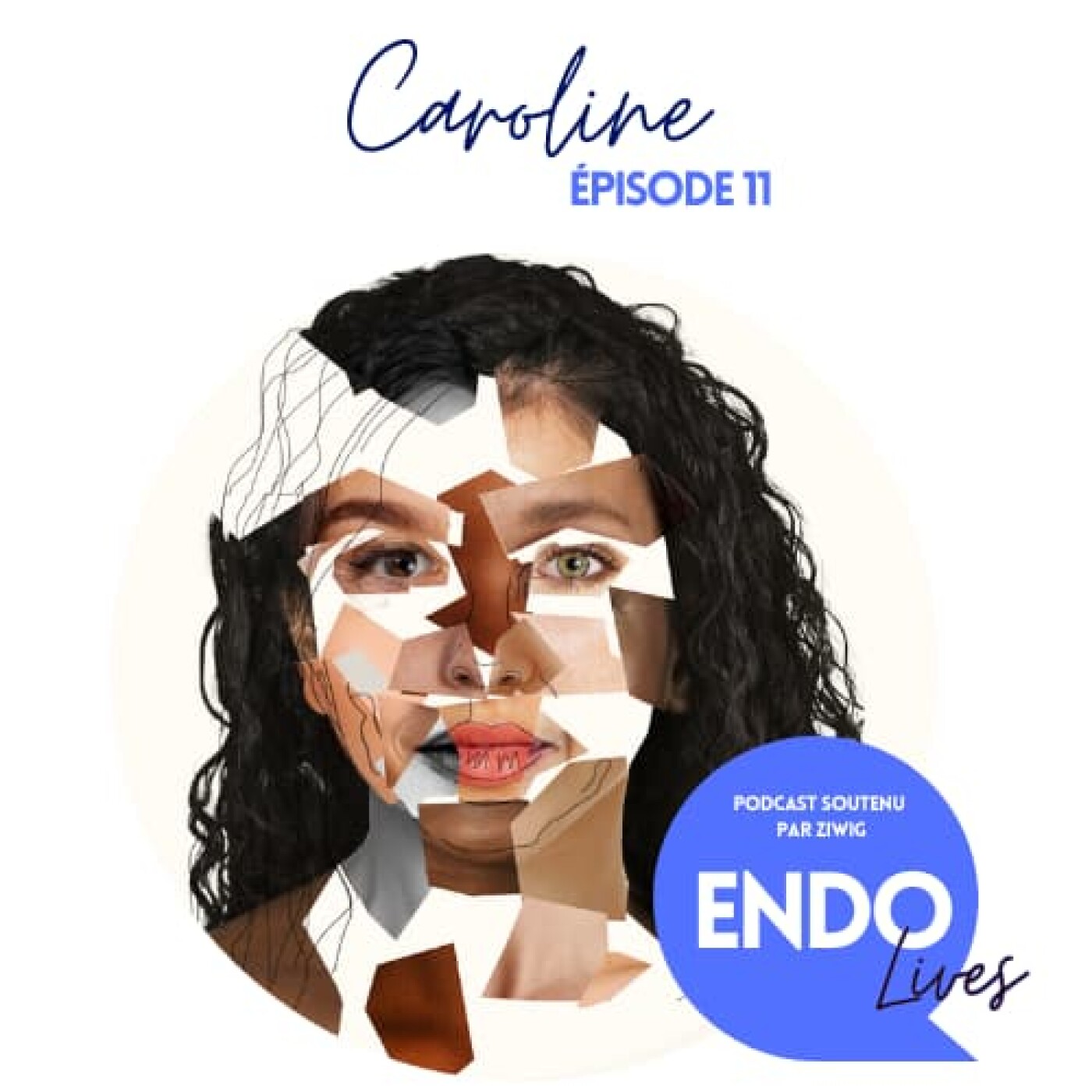 EndoLives - Le Podcast