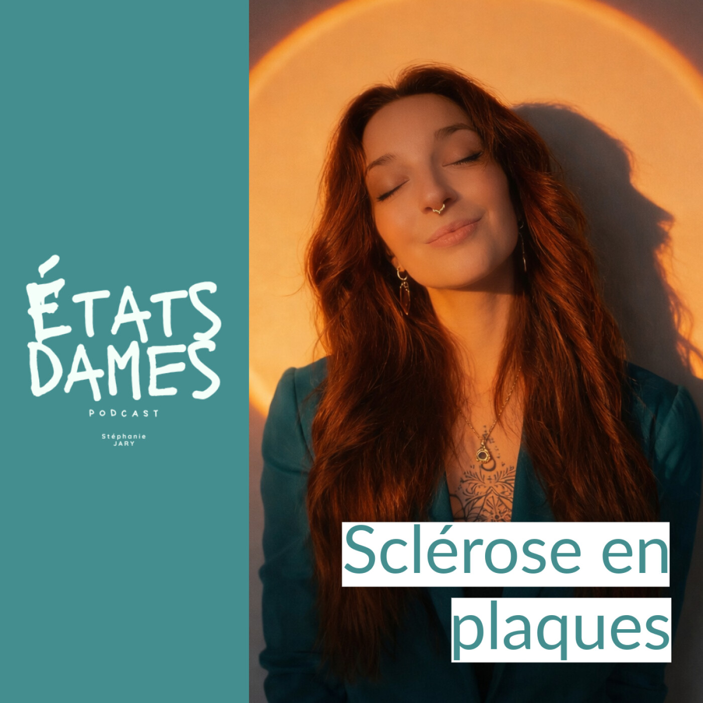 Au cœur de la sclérose en plaques : des mots sur des maux