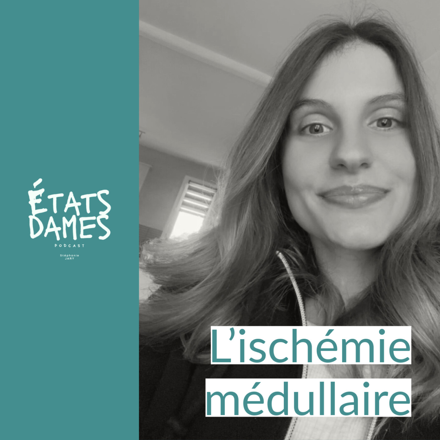 Au cœur de l’ischémie médullaire : du jour au lendemain, ma vie a basculé