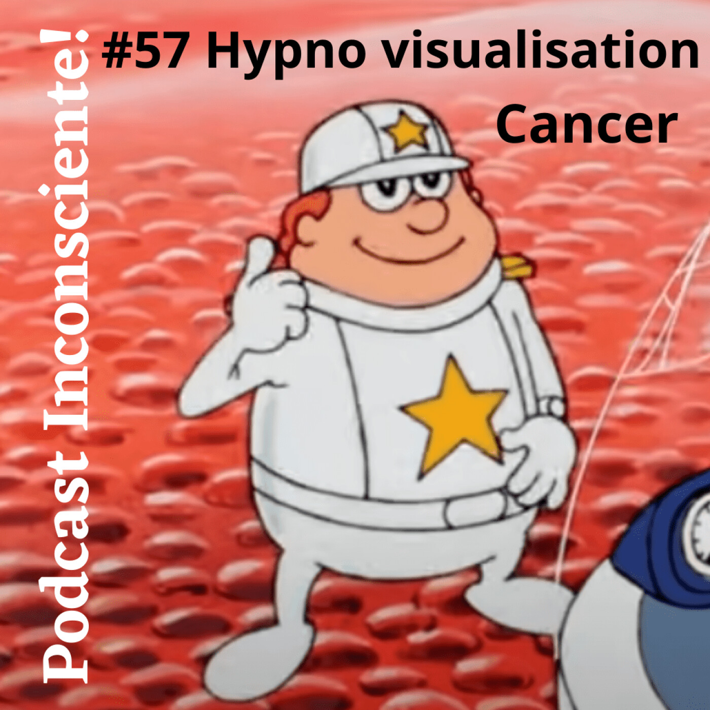 #57 HypnoVisualisation et cancer