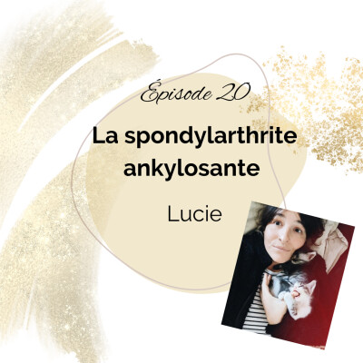 20 - Spondylarthrite ankylosante - Lucie cover