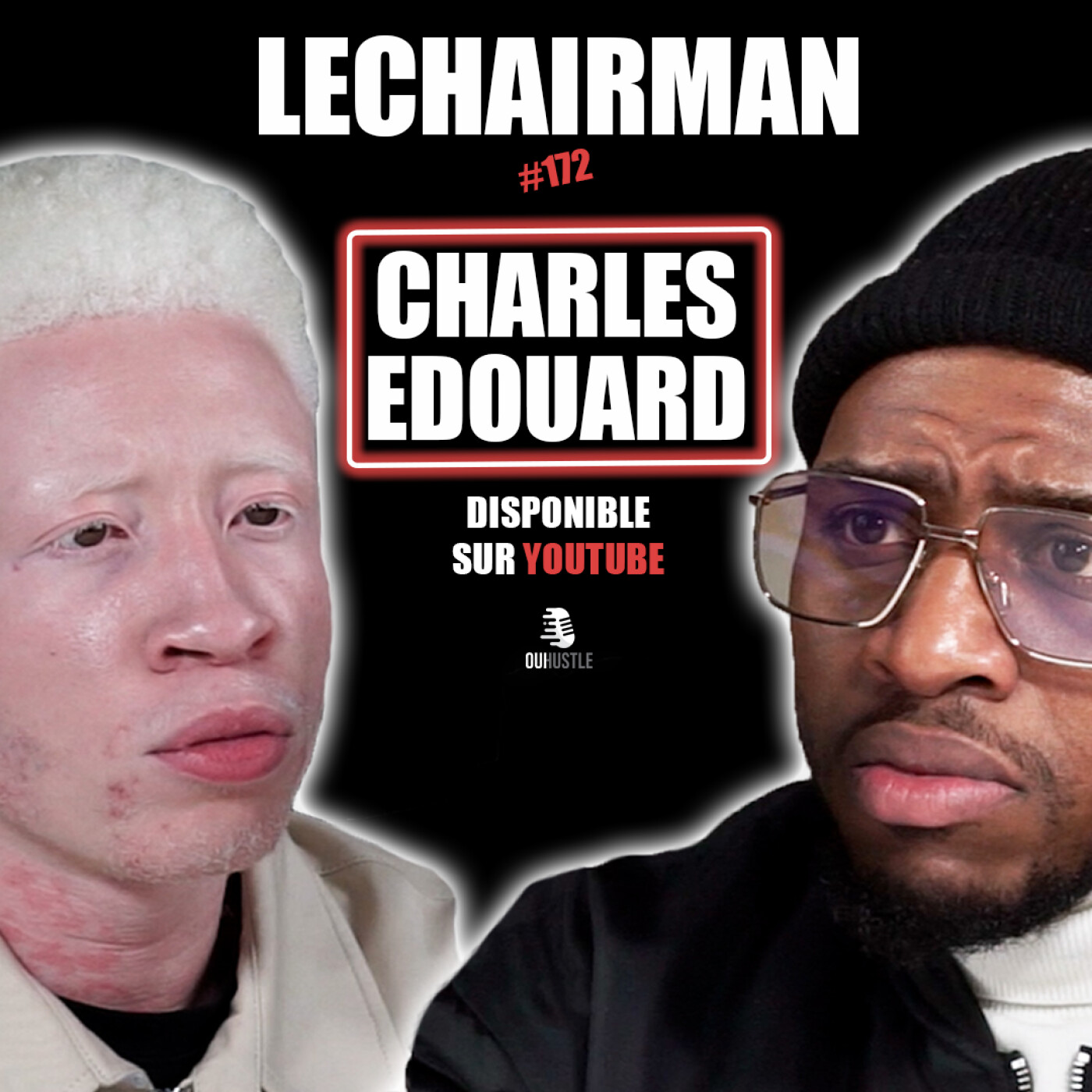 #172 LeChairman & Charles Édouard parlent Discrimination, Albinisme, Mannequinat, Dépression, Indeme