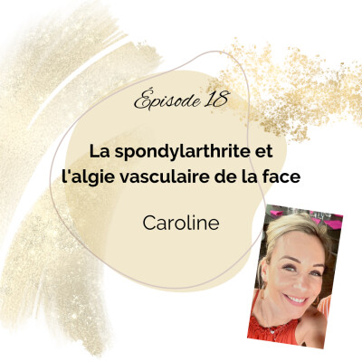 18 - Spondylarthrite et Algie vasculaire de la face - Caroline cover