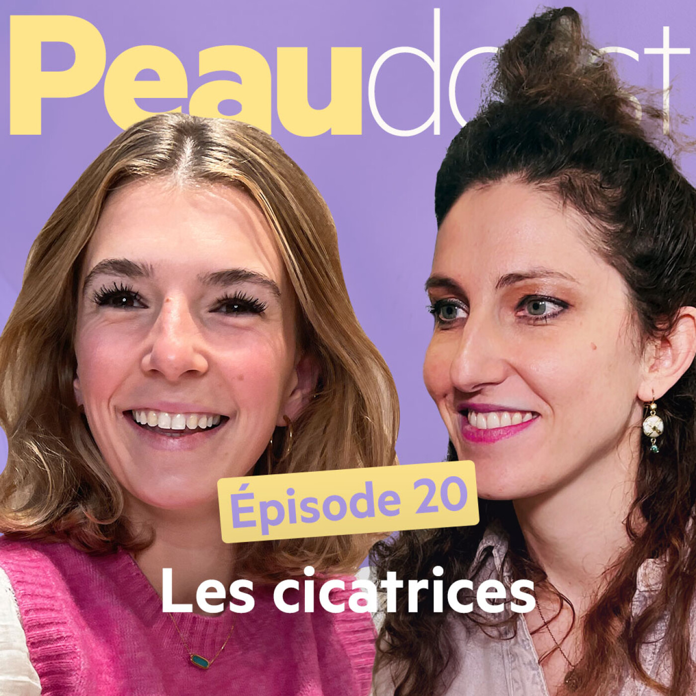 Peaudcast