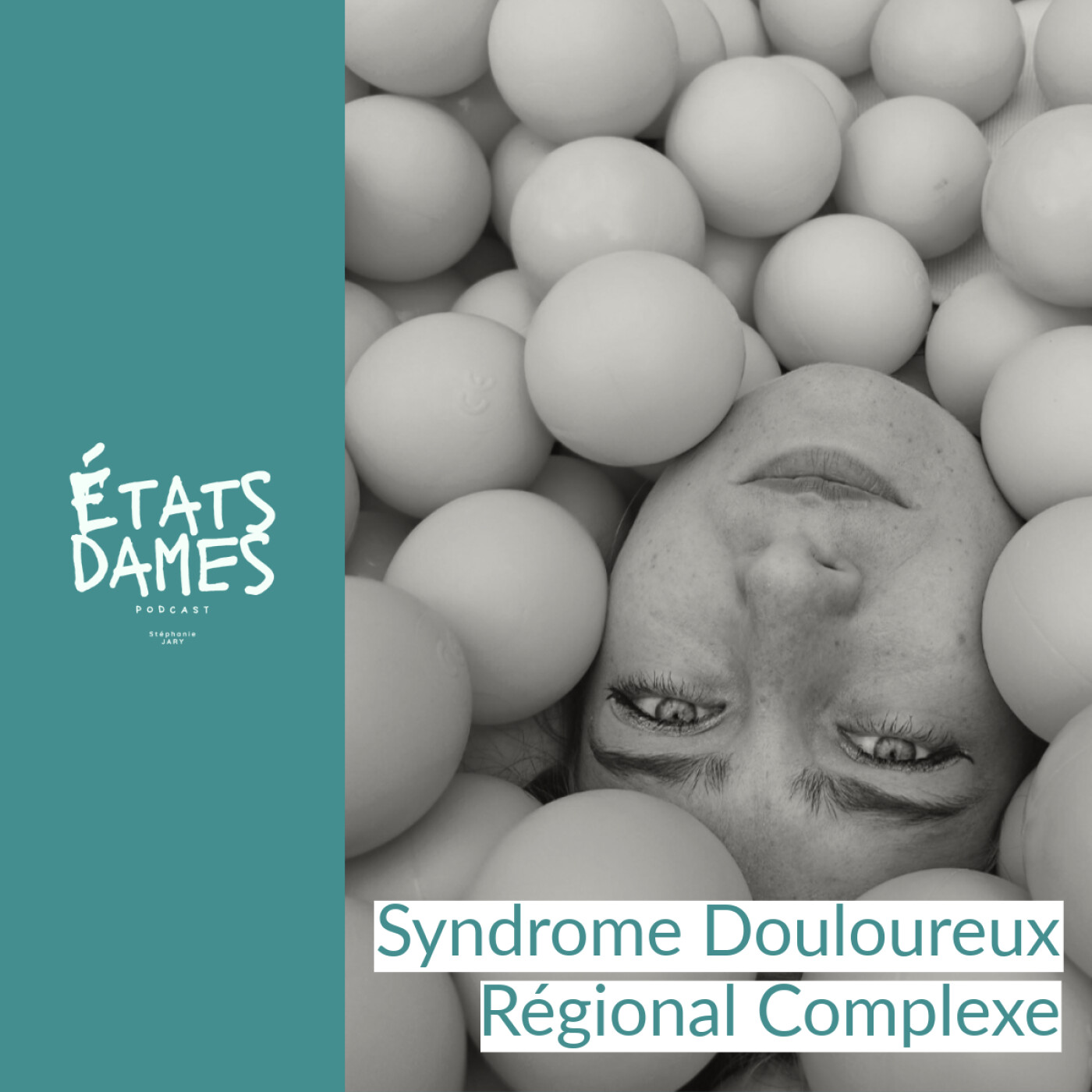 Au cœur du SDRC (Syndrome Douloureux Régional Complexe)