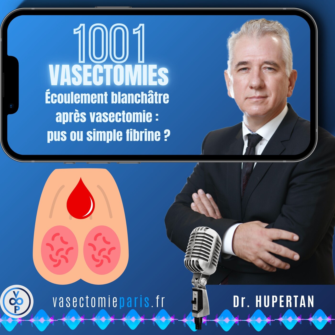 1001 Vasectomies