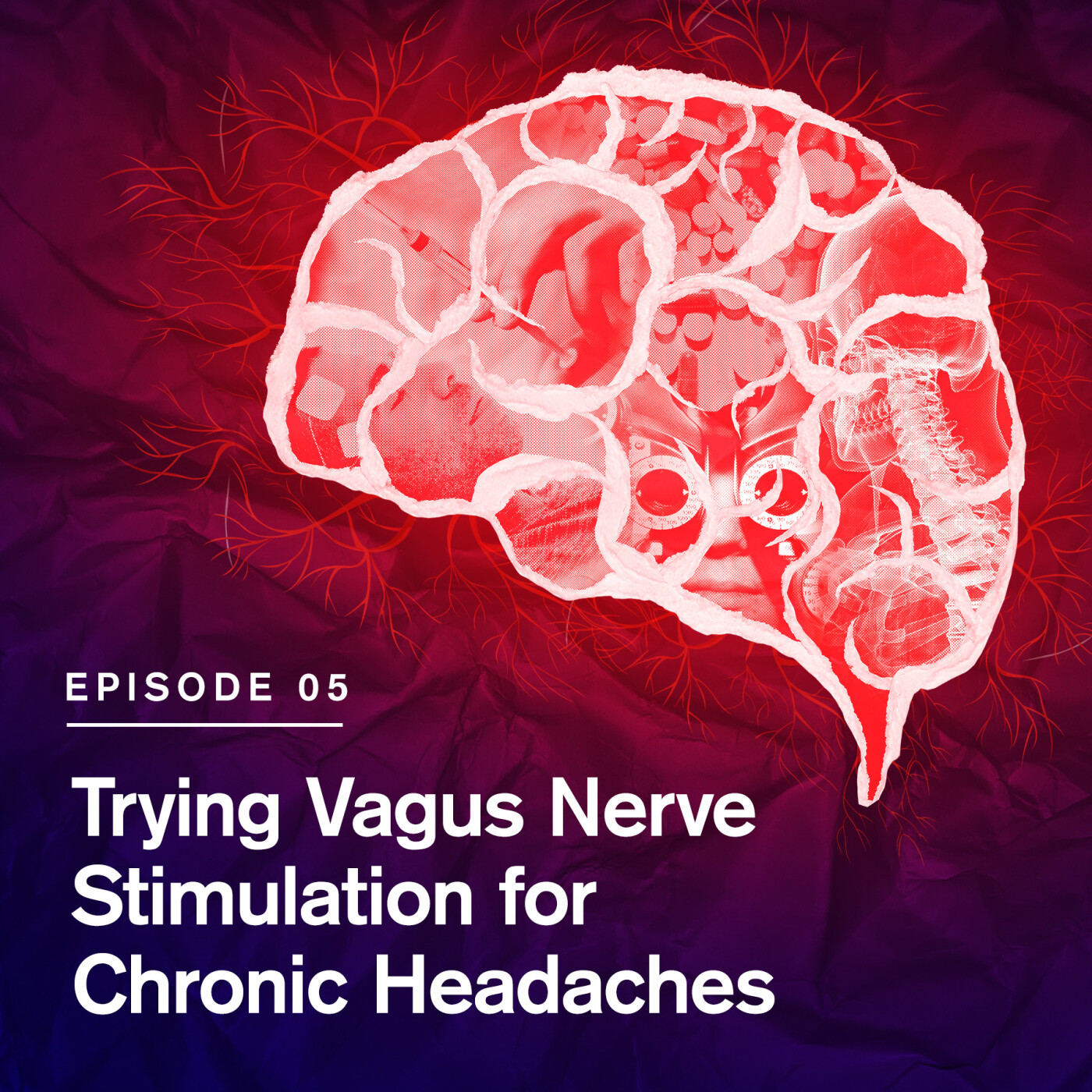 This Headache Journey