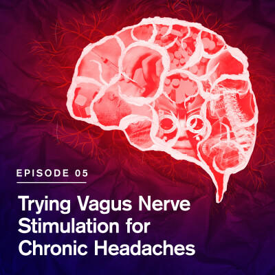 Trying Vagus Nerve Stimulation for Chronic Headaches cover