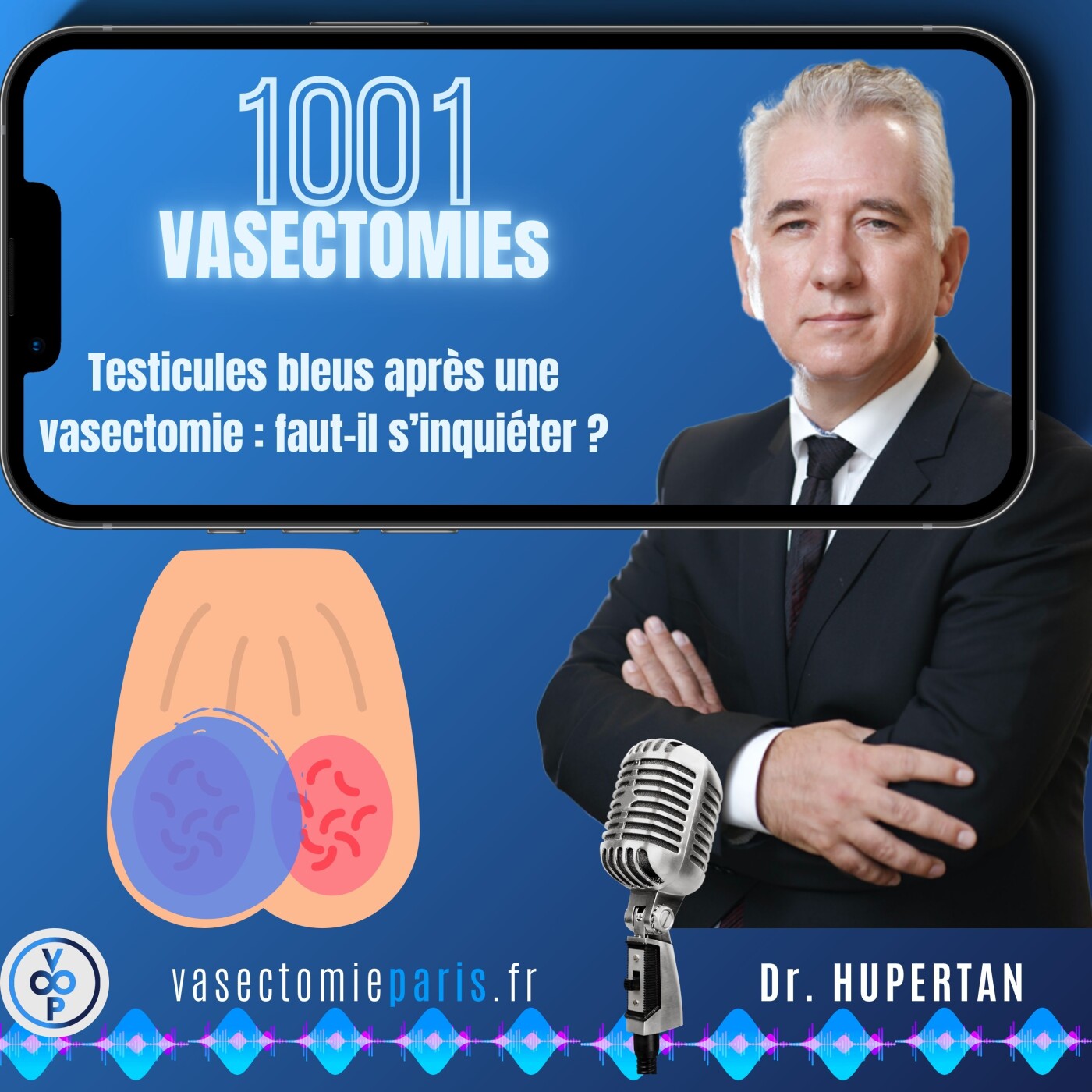 1001 Vasectomies