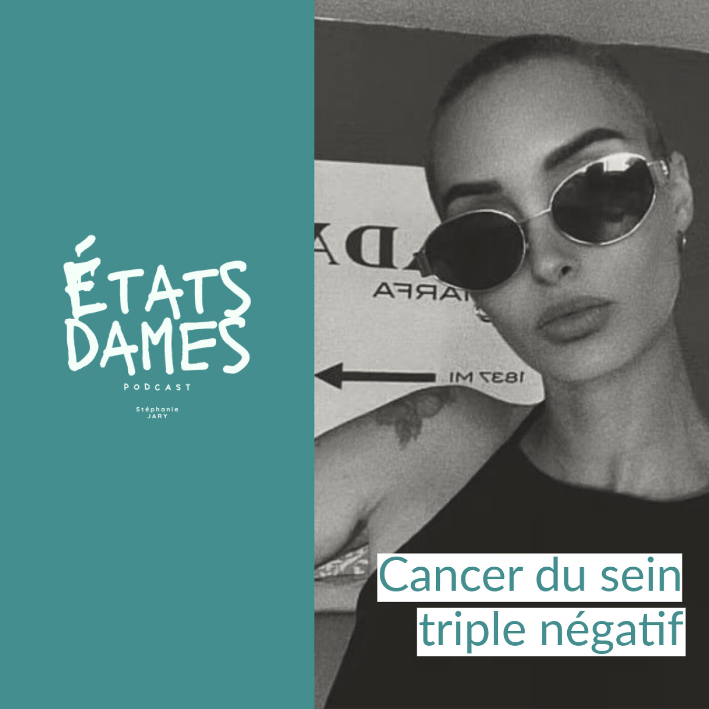 Au cœur d’un cancer du sein triple négatif