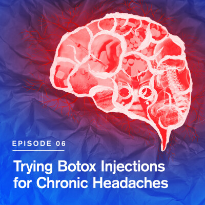 Trying Botox Injections for Chronic Headaches cover