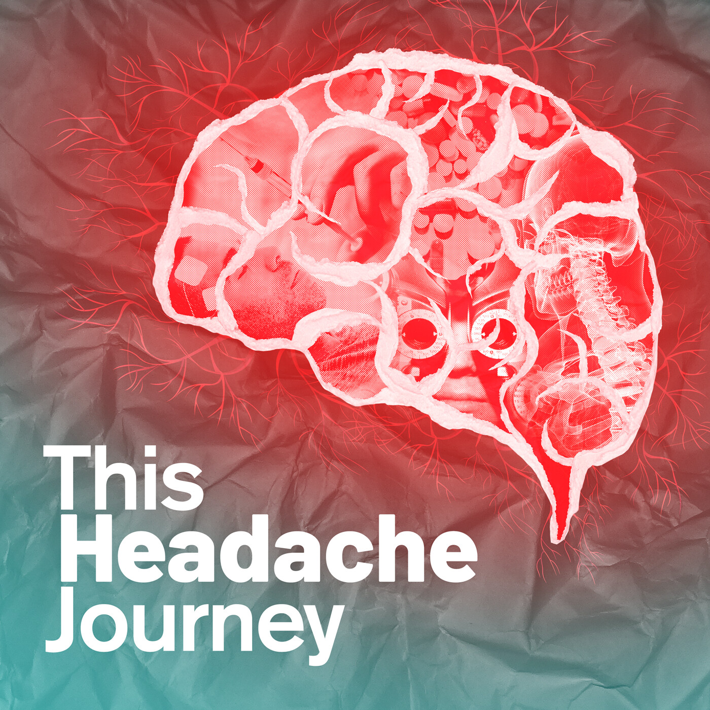This Headache Journey