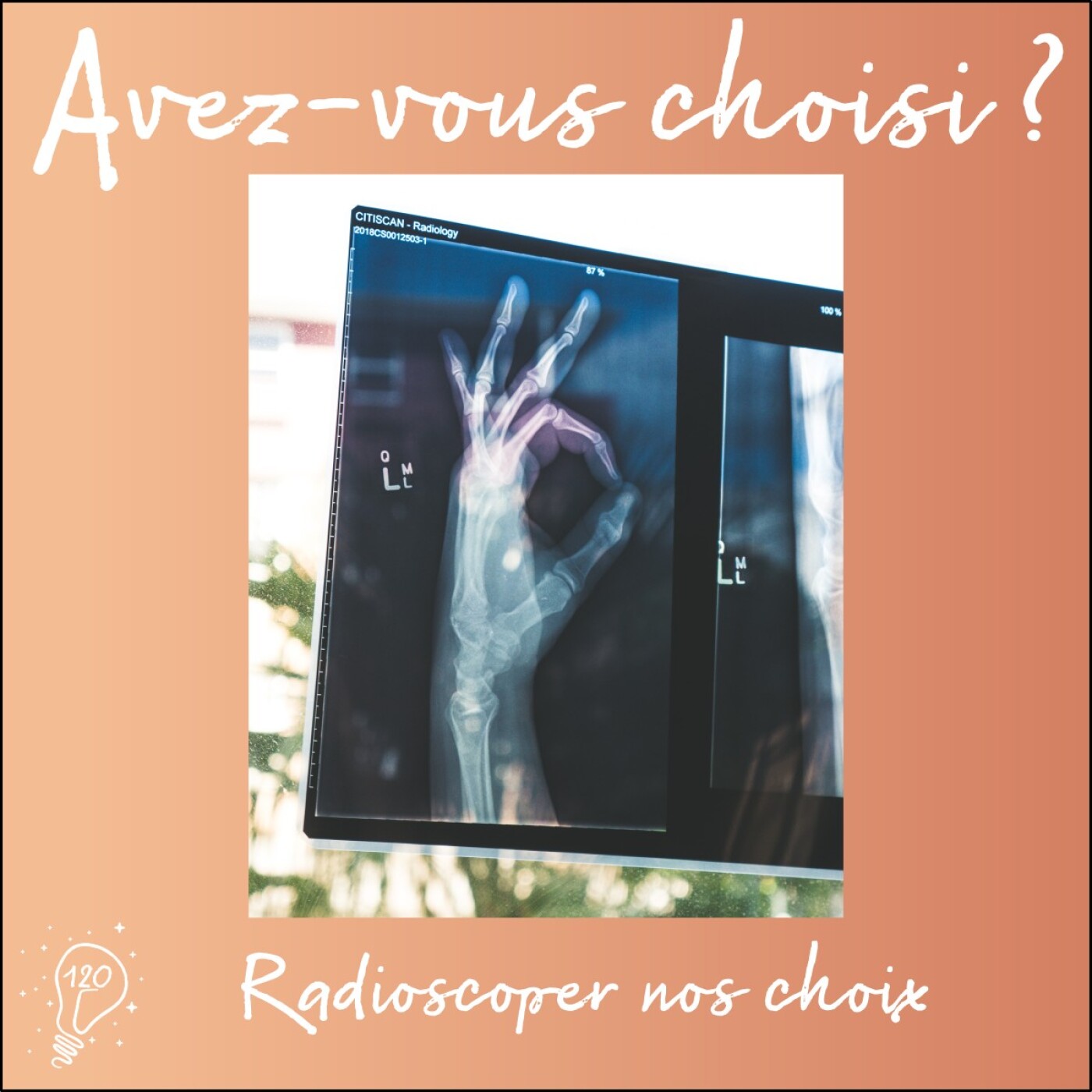 Avez-vous choisi ? - Episode 120 - Radioscoper nos choix