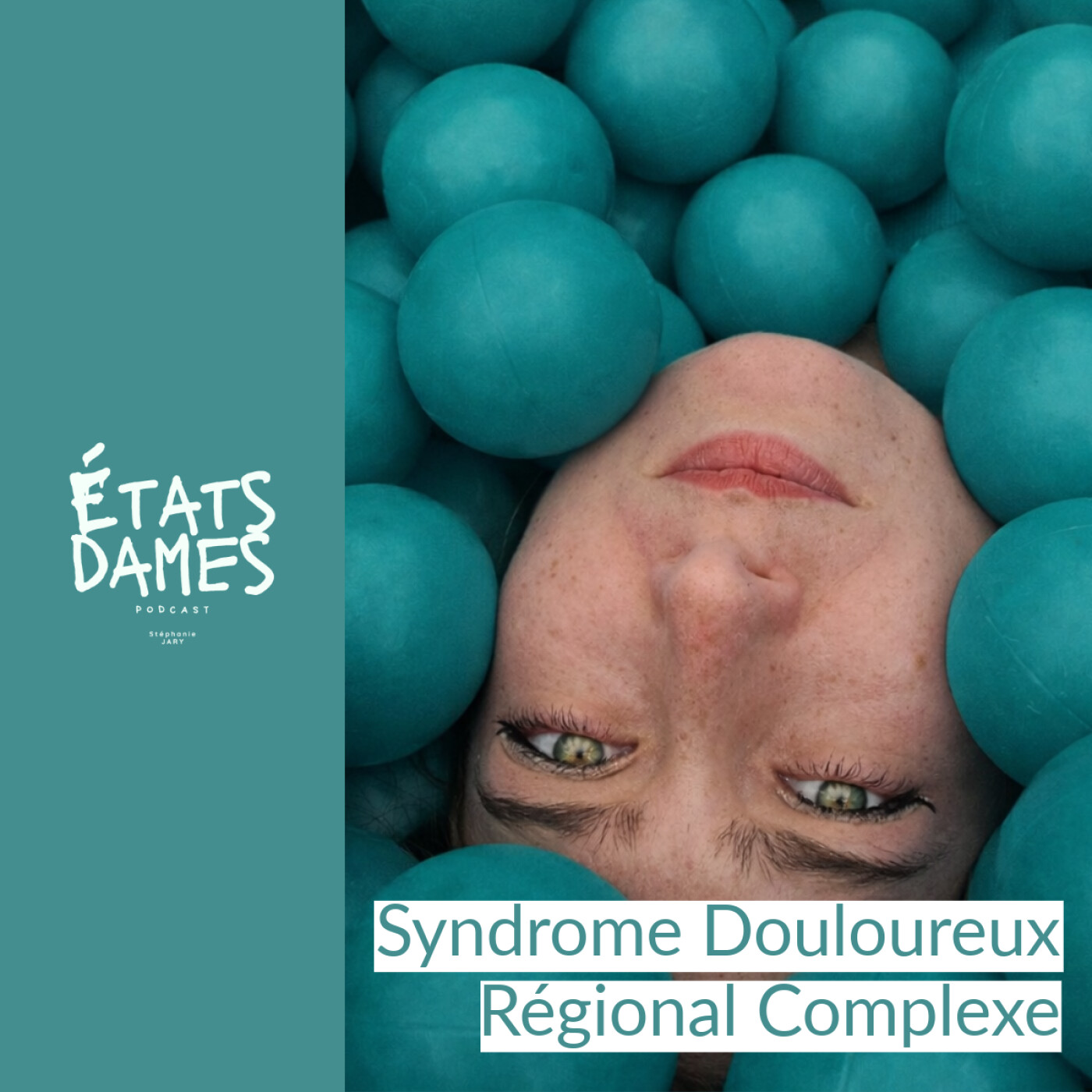 Au cœur du SDRC (Syndrome Douloureux Régional Complexe)