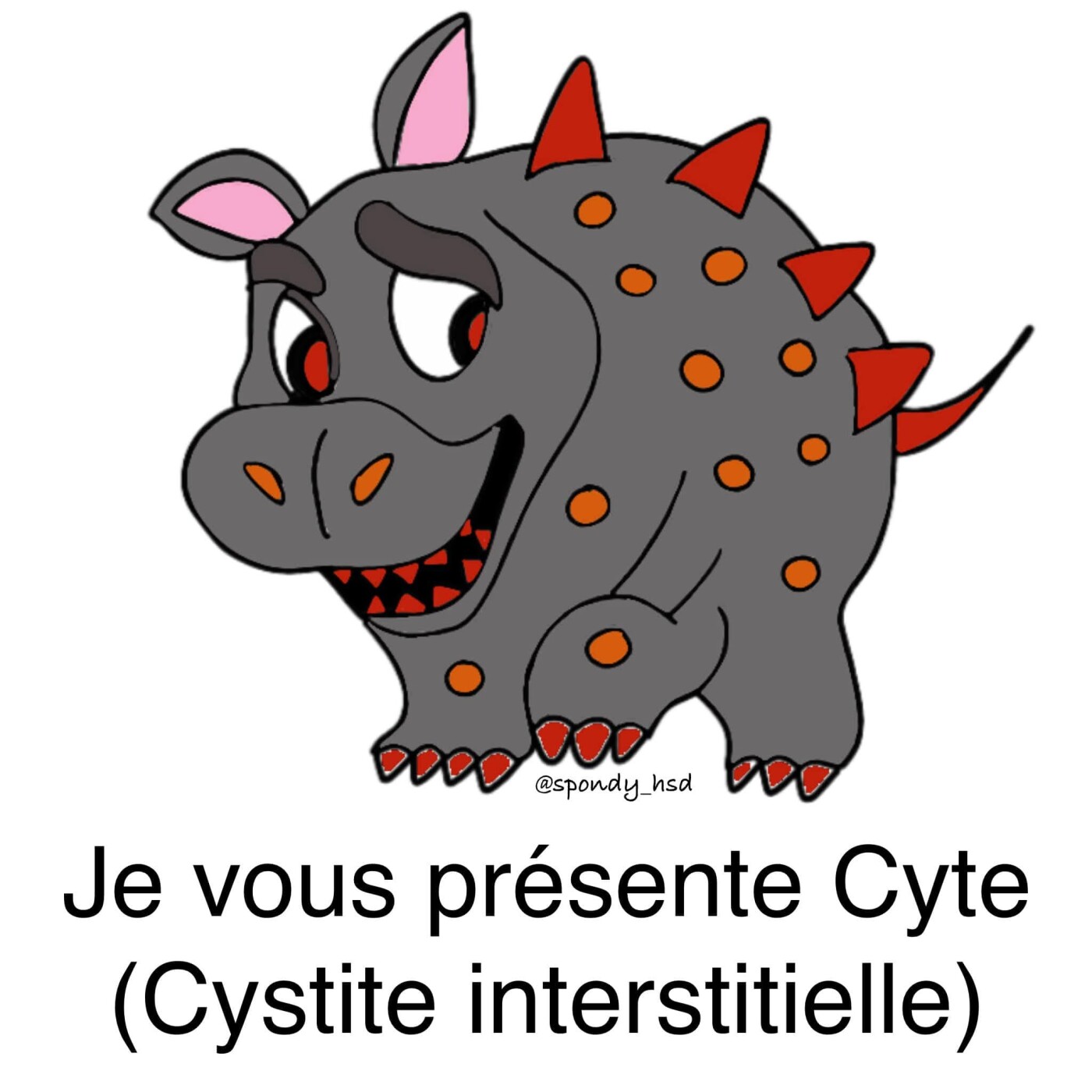 Cystite interstitielle