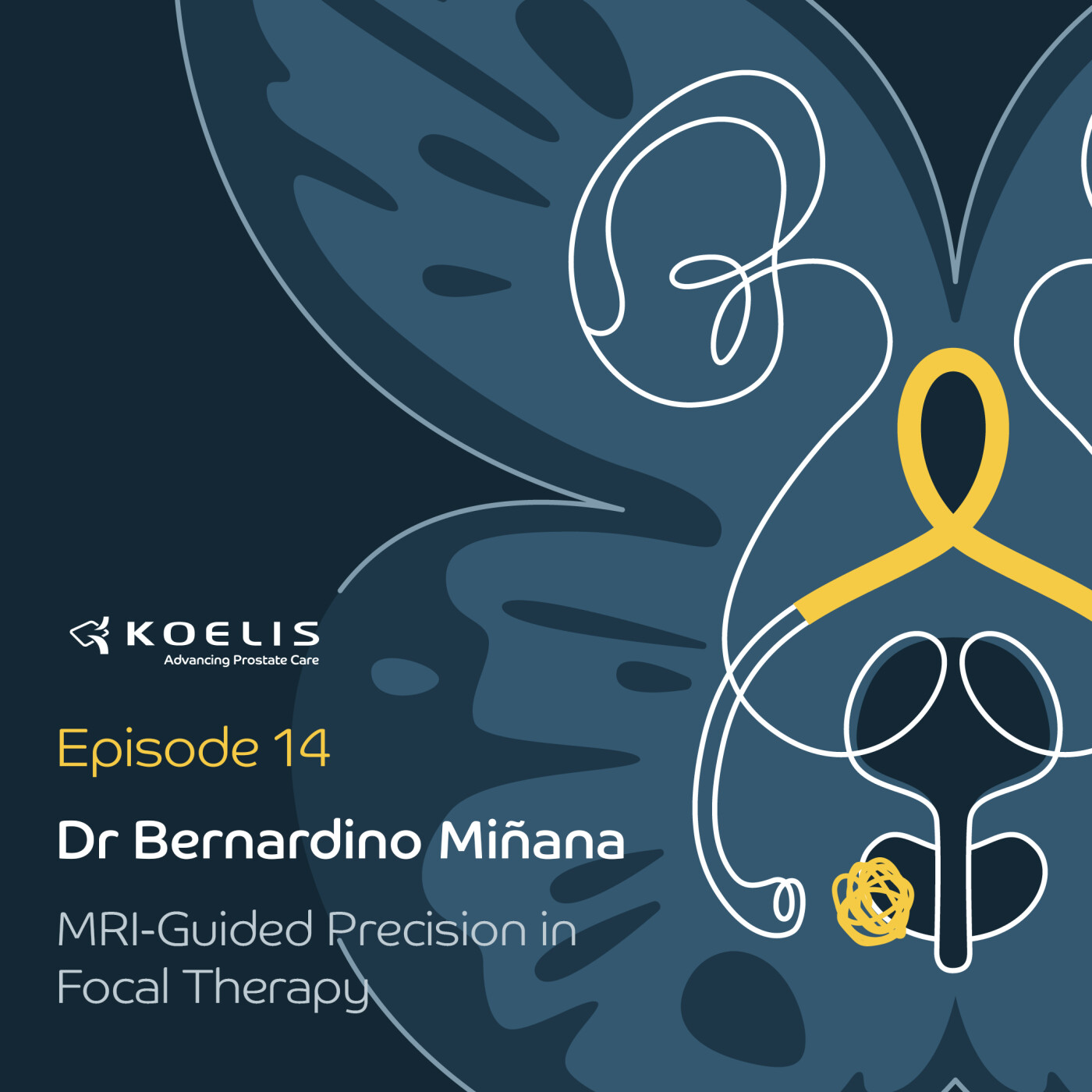 MRI-Guided Precision in Focal Therapy