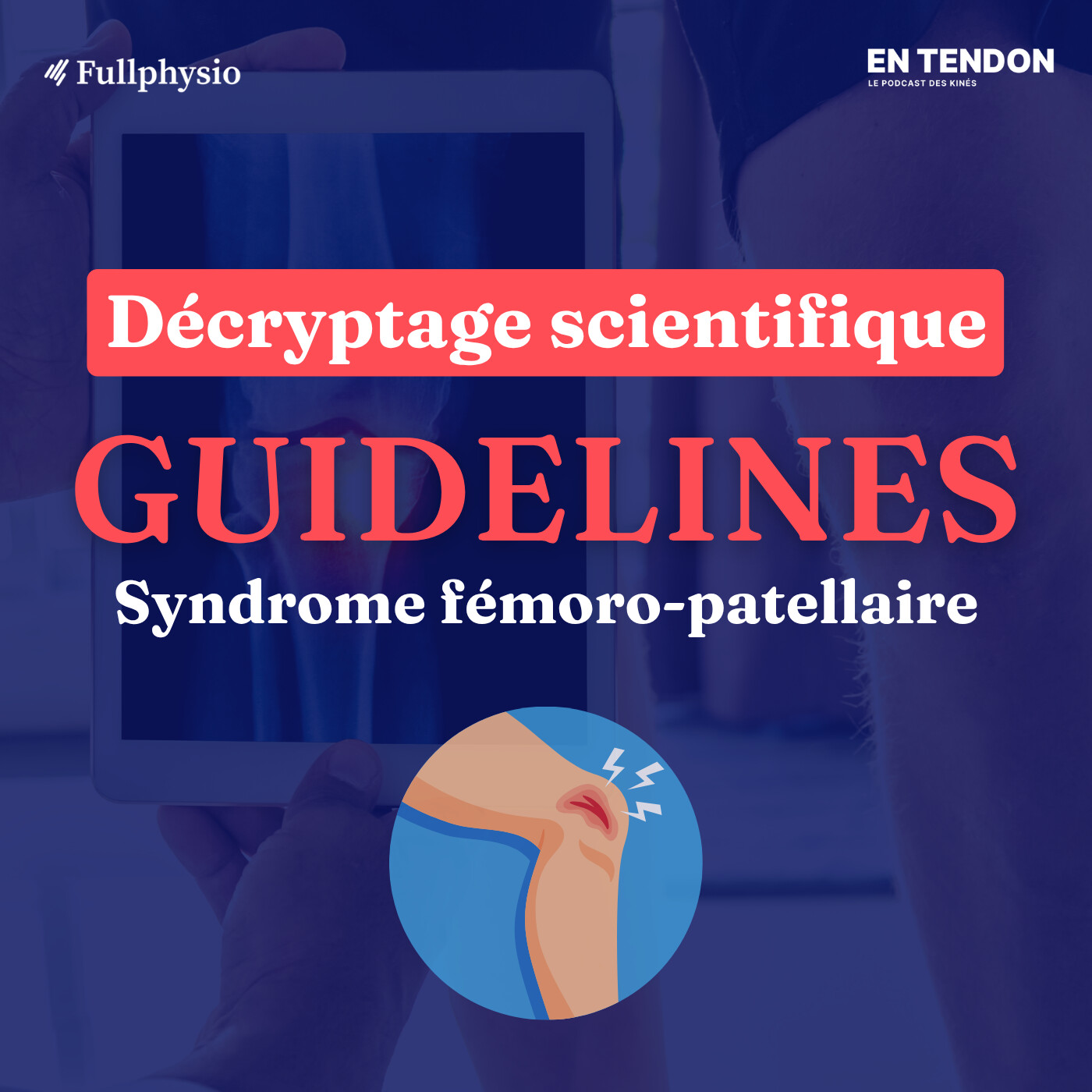 [Hors-série 3] Que faire en cas de SFP selon la science ? | Augustin Castel (@castel_physio), kinésithérapeute du sport & OMT
