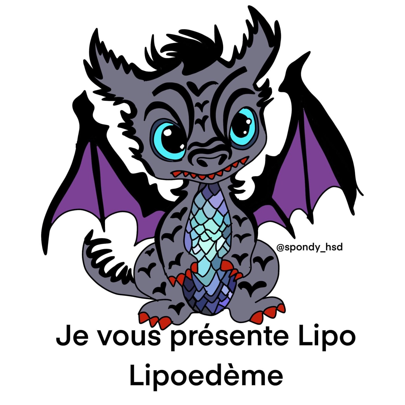 Lipœdème