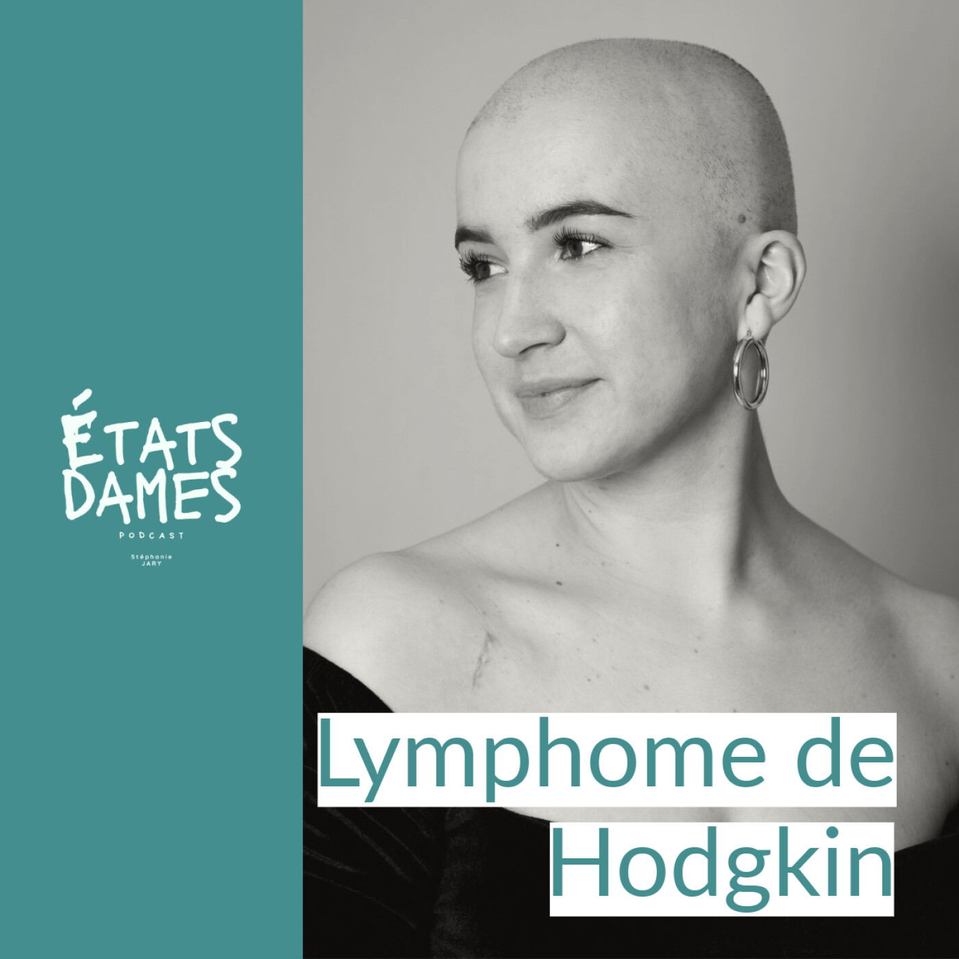 Au cœur du lymphome de Hodgkin stade 2 : La peur d’un deuxième round